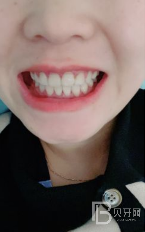 網(wǎng)友親身經(jīng)歷，齒康口腔做牙齒矯正怎么樣？靠譜嘛？