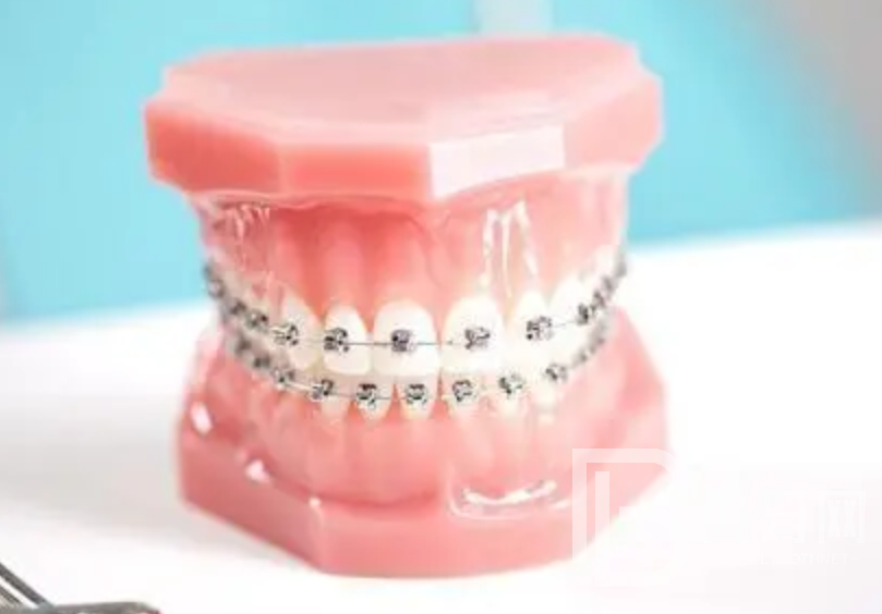 牙齒矯正為什么那么貴，牙齒矯正貴的原因是什么？