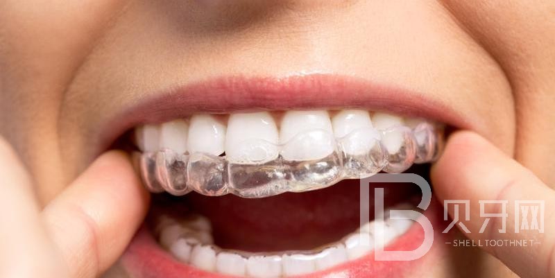 牙齒矯正后容易反彈嗎?這種情況需謹(jǐn)慎！