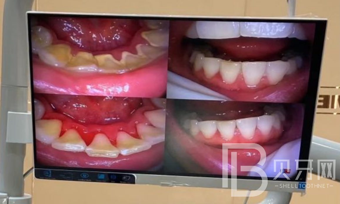 深圳佳美口腔口碑怎么樣？