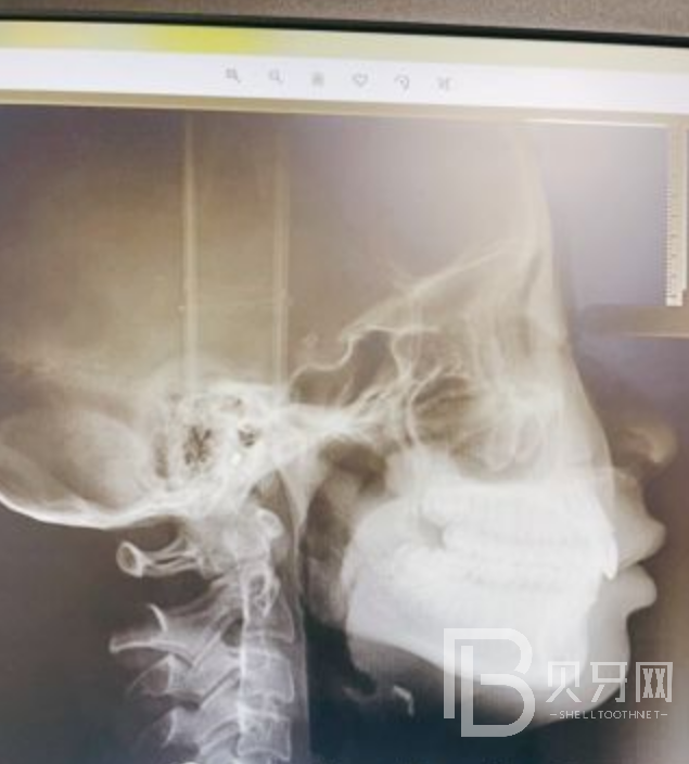 深圳瑞爾齒科做牙齒矯正靠譜嗎？