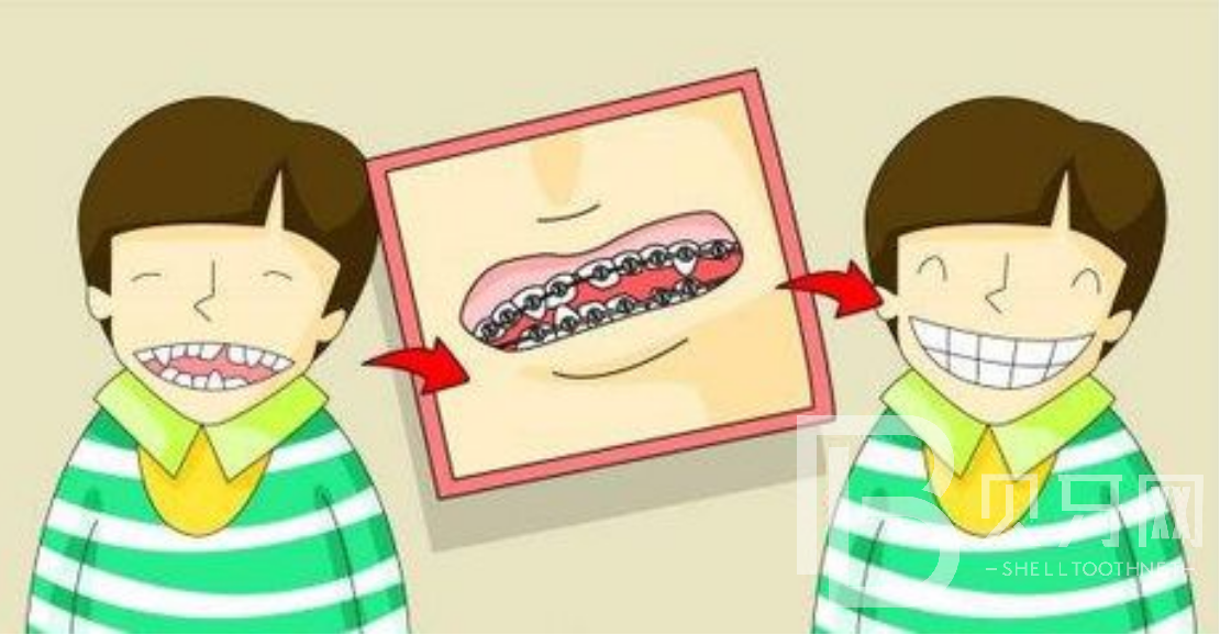 孩子牙齒不齊可以做牙齒矯正嗎？