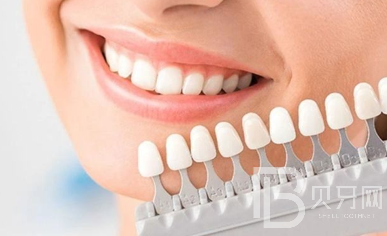 有沒有靠譜的牙齒美白方法？