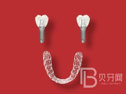 上海成人牙齒矯正大概價(jià)格多少錢，費(fèi)用價(jià)格都是怎么算的