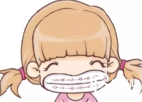 上海鑫齒口腔牙齒矯正好嗎？時(shí)代天使和隱適美有效果差別嗎？