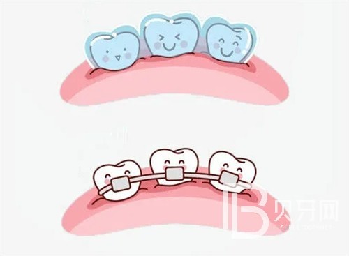 北京維樂口腔價(jià)目表曝光！種植牙和牙齒矯正價(jià)格這么便宜？