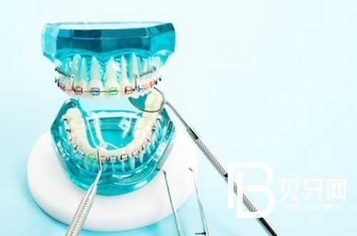 北京中諾口腔醫(yī)院靠譜不？中諾口腔牙齒矯正費(fèi)用高嗎？