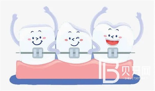 北京圣貝口腔牙齒矯正多少錢？你想了解的價(jià)格這里都有！