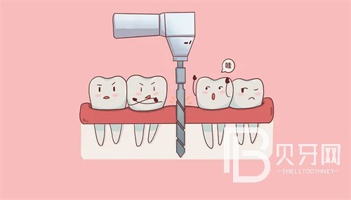 上海口腔醫(yī)院收費(fèi)高嗎?牙齒矯正/種植牙/牙貼面價(jià)格多少