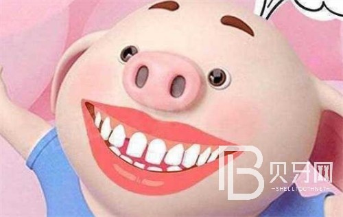 上海圣貝口腔牙齒矯正怎么樣？真實(shí)牙友口碑揭秘！