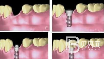 北京固爾口腔怎么樣？收費怎么樣？