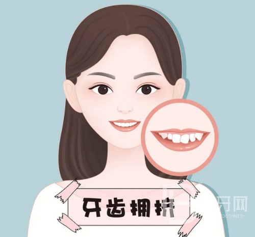 北京牙齒矯正大概要花費多少錢？公布2022年北京牙齒矯正價目表