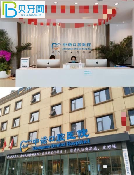 石家莊中諾口腔種植牙多少錢(qián)一顆