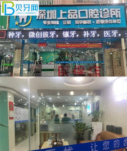 深圳上品口腔診所收費(fèi)標(biāo)準(zhǔn)價(jià)格表