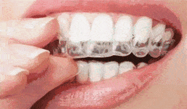 北京中諾口腔醫(yī)院種植牙技術好的醫(yī)院，好口碑不是空穴來風