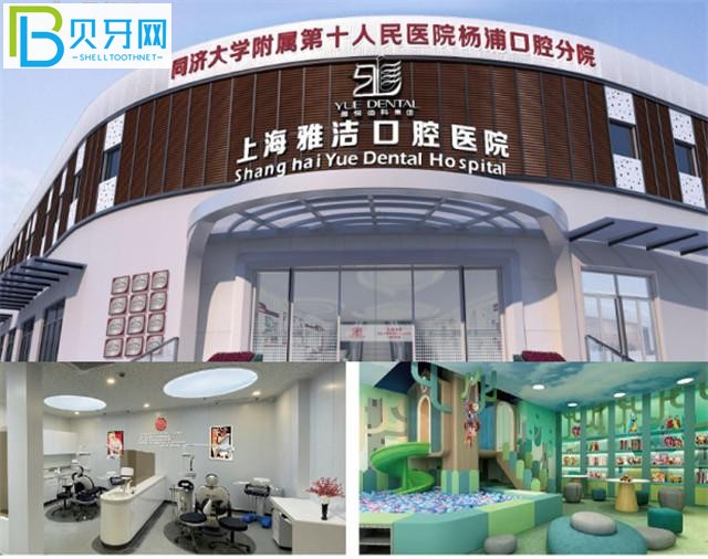 上海雅潔口腔醫(yī)院怎么樣 正規(guī)私立口碑好嗎收費貴嗎