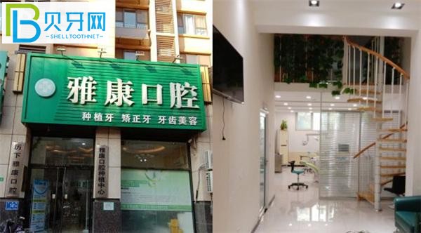 濟(jì)南雅康口腔種植牙好嗎