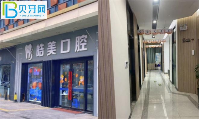 皓美口腔是正規(guī)醫(yī)院?jiǎn)?/></p>
<p>公民 3：</p>
<p>來(lái)常州好美口腔醫(yī)院看牙好多次了。我父母的種植牙和我自己的牙齒矯正都在這里完成，所以我經(jīng)常來(lái)這家牙醫(yī)?？傮w感覺(jué)還是比較靠譜的，環(huán)境、技術(shù)、服務(wù)都很好，性價(jià)比也高。是值得推薦的一張嘴。嚴(yán)&舒&李&網(wǎng)撰文，請(qǐng)勿轉(zhuǎn)載。</p>
            <p>以上是關(guān)于<strong>常州皓美口腔醫(yī)院怎么樣，可以刷社?？▎?圖)</strong>的相關(guān)介紹，想要了解更多醫(yī)生，案例等內(nèi)容，歡迎在線咨詢客服哦。</p>
            <div   id="cljrrqk4jn"   class="content_tag">
                <div   id="cljrrqk4jn"   class="content_tag_left">關(guān)鍵詞：</div>
                <div   id="cljrrqk4jn"   class="content_tag_right">
                     
                    <a class="content_tag_right_item" href="/tag/%E6%B1%9F%E8%8B%8F%E5%B8%B8%E5%B7%9E">江蘇常州</a> 
                     
                    <a class="content_tag_right_item" href="/tag/%E5%8F%A3%E8%85%94%E6%8A%A4%E7%90%86">口腔護(hù)理</a> 
                    
                </div>
            </div>
            <p class="ask_doctor">
                <a ><img src="/static/images/dibuzx.jpg" title="" alt="在線咨詢" rel="nofollow"></a>
            </p>
            <p class="show_bianji">編輯：</p>
        </div>
        <div   id="cljrrqk4jn"   class="fr width_fr mohutupian">
            <!--  -->
            <div   id="cljrrqk4jn"   class="zixun_gonglue mt0 margin_l">
                <h3><i></i>牙友點(diǎn)評(píng)<a href="/list_3/" class="fr mor_l"><span>更多></span></a></h3>
                 
                <ul>
                    <li>
                        <a href="/list_3/5051.html" class="img"><img src="/static/upload/images/y20221202/z5yxgq1v4dz.jpg" alt="浙江衢州鹿鳴口腔門(mén)診怎么樣？"></a>
                        <p class="tit"><a href="/list_3/5051.html">浙江衢州鹿鳴口腔門(mén)診怎么樣？</a></p>
                        <p class="txt">浙江衢州鹿鳴口腔門(mén)診怎么樣？浙江衢州鹿鳴口腔門(mén)診是一家以提供優(yōu)質(zhì)服務(wù)為特色的口碑門(mén)診。醫(yī)院環(huán)境溫馨舒適，裝修精致，積累了很好的口碑評(píng)價(jià)。1.浙江衢州鹿鳴口腔門(mén)診···<a href="/list_3/5051.html">[詳細(xì)]</a></p>
                    </li>
                </ul>
                 
                <ul>
                    <li>
                        <a href="/list_3/5050.html" class="img"><img src="/static/upload/images/y20221202/ktg5akngtcc.jpg" alt="蘇州康橋口腔醫(yī)院電話了解詳情，想了解客戶口碑"></a>
                        <p class="tit"><a href="/list_3/5050.html">蘇州康橋口腔醫(yī)院電話了解詳情，想了解客戶口碑</a></p>
                        <p class="txt">有朋友在后臺(tái)咨詢。我想知道蘇州康橋口腔醫(yī)院的評(píng)價(jià)是否好。我還打電話了解細(xì)節(jié)。為什么這么麻煩？本文是小編探店評(píng)估記錄。如果你想了解客戶的聲譽(yù)，請(qǐng)看這里！一、蘇州康···<a href="/list_3/5050.html">[詳細(xì)]</a></p>
                    </li>
                </ul>
                 
                <ul>
                    <li>
                        <a href="/list_3/5048.html" class="img"><img src="/static/upload/images/y20221202/azgp4rwnrhk.jpg" alt="上海奉浦醫(yī)院口腔科是坑人嗎？ 看完最近的口碑評(píng)價(jià)，我明白了"></a>
                        <p class="tit"><a href="/list_3/5048.html">上海奉浦醫(yī)院口腔科是坑人嗎？ 看完最近的口碑評(píng)價(jià)，我明白了</a></p>
                        <p class="txt">上海奉浦醫(yī)院口腔科是一個(gè)合格的口腔診療科，醫(yī)生團(tuán)隊(duì)也經(jīng)過(guò)了嚴(yán)格的篩選。為所有來(lái)醫(yī)院的患者創(chuàng)造一個(gè)穩(wěn)定的醫(yī)療質(zhì)量體驗(yàn)和舒適的牙科護(hù)理環(huán)境。奉浦醫(yī)院的聲譽(yù)好嗎？上?！ぁぁ?a href="/list_3/5048.html">[詳細(xì)]</a></p>
                    </li>
                </ul>
                 
                <ul>
                    <li>
                        <a href="/list_3/5046.html" class="img"><img src="/static/upload/images/y20221202/12mld3v4pbd.jpg" alt="金華蘭溪性價(jià)比高的牙科有哪些？金華卓奧口腔怎么樣？"></a>
                        <p class="tit"><a href="/list_3/5046.html">金華蘭溪性價(jià)比高的牙科有哪些？金華卓奧口腔怎么樣？</a></p>
                        <p class="txt">金華哪個(gè)牙科好？蘭溪市正規(guī)實(shí)惠的牙科有哪些？經(jīng)過(guò)小編的方便評(píng)價(jià)，我們找到了一個(gè)合格、價(jià)格實(shí)惠、口碑好的牙科。這是金華卓奧口腔。為什么推薦？請(qǐng)直接看下面的評(píng)論。金···<a href="/list_3/5046.html">[詳細(xì)]</a></p>
                    </li>
                </ul>
                 
                <ul>
                    <li>
                        <a href="/list_3/5044.html" class="img"><img src="/static/upload/images/y20221202/jqf2x1lt3e5.jpg" alt="杭州富陽(yáng)金鉑利口怎么樣？口碑好嗎？市民說(shuō)正規(guī)便宜好。"></a>
                        <p class="tit"><a href="/list_3/5044.html">杭州富陽(yáng)金鉑利口怎么樣？口碑好嗎？市民說(shuō)正規(guī)便宜好。</a></p>
                        <p class="txt">杭州還有很多大大小小的口腔醫(yī)院和診所，那么杭州哪個(gè)牙科比較好呢？杭州富陽(yáng)金白金口腔怎么樣？口碑好嗎？根據(jù)當(dāng)?shù)厥忻竦姆答?，醫(yī)院正規(guī)可靠的牙科技術(shù)還可以，收費(fèi)價(jià)格合···<a href="/list_3/5044.html">[詳細(xì)]</a></p>
                    </li>
                </ul>
                
            </div>
        </div>
    </div>
</div>
<div   id="cljrrqk4jn"   class="list_kecheng layout">
    <h3 class="rem_title" style="width: 100%;">相關(guān)推薦</h3>
    <div   id="cljrrqk4jn"   class="rem_box">
         
        <div   id="cljrrqk4jn"   class="rem_item">
            <a href="/list_3/5051.html">浙江衢州鹿鳴口腔門(mén)診怎么樣？</a>
        </div>
         
        <div   id="cljrrqk4jn"   class="rem_item">
            <a href="/list_3/5050.html">蘇州康橋口腔醫(yī)院電話了解詳情，想了解客戶口碑</a>
        </div>
         
        <div   id="cljrrqk4jn"   class="rem_item">
            <a href="/list_3/5048.html">上海奉浦醫(yī)院口腔科是坑人嗎？ 看完最近的口碑評(píng)價(jià)，我明白了</a>
        </div>
         
        <div   id="cljrrqk4jn"   class="rem_item">
            <a href="/list_3/5046.html">金華蘭溪性價(jià)比高的牙科有哪些？金華卓奧口腔怎么樣？</a>
        </div>
         
        <div   id="cljrrqk4jn"   class="rem_item">
            <a href="/list_3/5044.html">杭州富陽(yáng)金鉑利口怎么樣？口碑好嗎？市民說(shuō)正規(guī)便宜好。</a>
        </div>
         
        <div   id="cljrrqk4jn"   class="rem_item">
            <a href="/list_3/5042.html">吉林愛(ài)牙口腔門(mén)診部好嗎？我們來(lái)看看口碑如何附地址。</a>
        </div>
         
        <div   id="cljrrqk4jn"   class="rem_item">
            <a href="/list_3/5039.html">長(zhǎng)沙優(yōu)仕口腔好嗎？患者的口碑評(píng)價(jià)如何？</a>
        </div>
         
        <div   id="cljrrqk4jn"   class="rem_item">
            <a href="/list_3/5037.html">南通美奧口腔門(mén)診怎么樣？正式嗎？附門(mén)診時(shí)間和地址</a>
        </div>
        
    </div>
</div>
<footer>
            <div   id="cljrrqk4jn"   class="footer">
                <div   id="cljrrqk4jn"   class="layout clearfix">
                    <img src="/static/images/tmlogo.png" class="fl footer_logo" width="185" style="height:auto">
                    <ul class="fl">
                        <li id="cljrrqk4jn"    class="footer_nav">
                            
                            <a href="/news_1091/" title="口腔醫(yī)院排名" target="_blank">口腔醫(yī)院排名</a>
                            
                            
                            <a href="/news_1100/" title="口腔醫(yī)院價(jià)格" target="_blank">口腔醫(yī)院價(jià)格</a>
                            
                            
                            <a href="/pages_21/" rel="nofollow">關(guān)于我們</a>
                            
                            <a href="/pages_22/" rel="nofollow">聯(lián)系我們</a>
                            
                            <a href="/index.php/sitemap.xml" target="_blank">網(wǎng)站地圖</a>
                            
                            <a href="/pages_23/" rel="nofollow">版權(quán)申明</a>
                            
                            <div   id="cljrrqk4jn"   class="ba_398">
                                <a  target="_blank" rel="nofollow">網(wǎng)站備案號(hào)：京ICP備2022003338號(hào)-1</a>
                            </div>
                        </li>
                        <li>免責(zé)聲明：本網(wǎng)站部分內(nèi)容來(lái)源于公眾平臺(tái)及網(wǎng)絡(luò)，如有侵犯版權(quán)請(qǐng)聯(lián)系我們</li>
                    </ul>
                    <p class="footer_weixin fl">
                        <span>手機(jī)版</span>
                        <img src="/static/upload/image/20220213/1644733911763517.png" class="Wx_img" alt="">
                    </p>
                </div>
            </div>
        </footer>
        
        
	
<!--
<style>
img:after{
    content: 