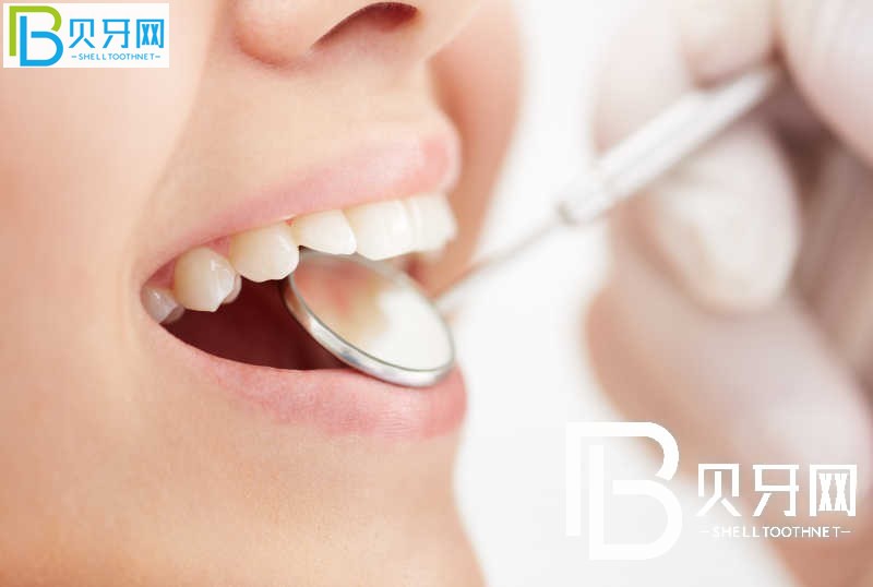 深圳寶港口腔怎么樣？醫(yī)院靠譜嗎？