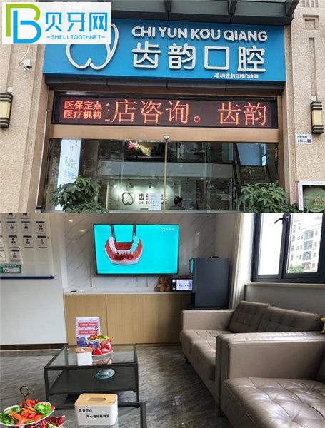 深圳齒韻口腔收費標準