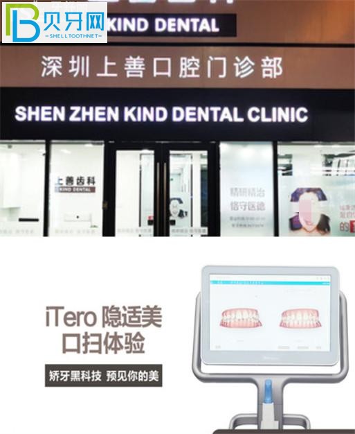 深圳上善齒科收費(fèi)標(biāo)準(zhǔn)價格表