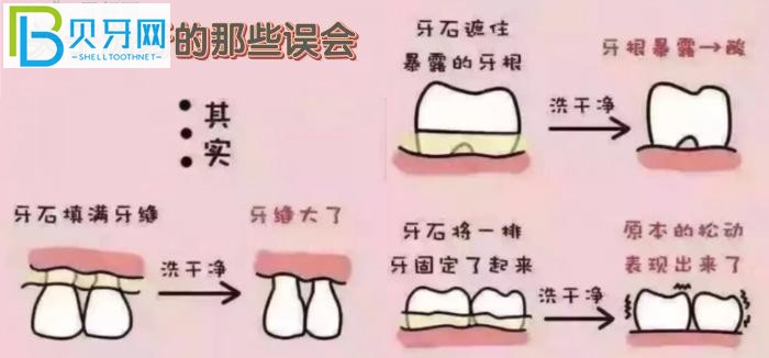 萬州牙科醫(yī)院哪里好？推薦品善和牙博士兩家口碑好的牙科診所給你！