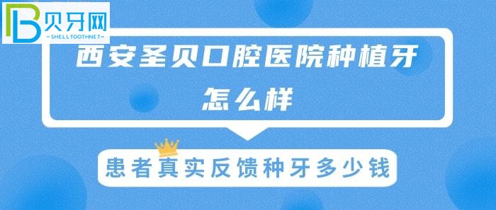 西安圣貝種植牙怎么樣，患者真實(shí)反饋種牙多少錢？(圖)