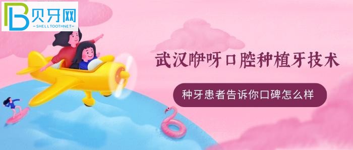 All-on-4/6種植牙技術(shù)好不好？(組圖)