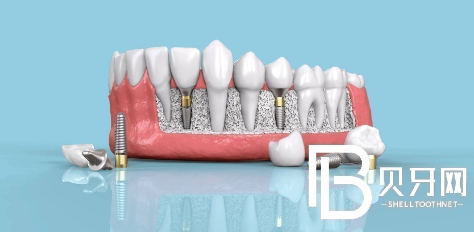 深圳爾睦口腔正規(guī)嗎？看牙貴不貴？