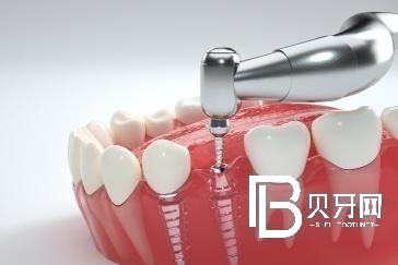 北京牙齒缺失該怎么修復(fù)？北京京一口腔門診部怎么樣？