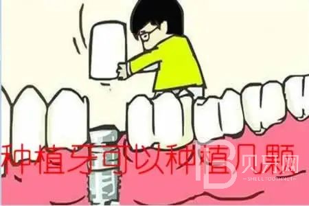 allon6種植牙是什么意思？東莞拜爾口腔
